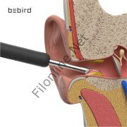 BEBIRD R1 AKILLI GÖRÜNTÜLÜ KULAK İÇİ TEMİZLEYİCİ KABLOSUZ  KAMERALI KULAK OTOSKOP TEMİZLEYİCİ BEYAZ