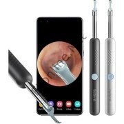 BEBIRD R1 AKILLI GÖRÜNTÜLÜ KULAK İÇİ TEMİZLEYİCİ KABLOSUZ  KAMERALI KULAK OTOSKOP TEMİZLEYİCİ BEYAZ